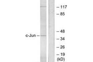 Western blot analysis of extracts from HeLa cells, using c-Jun (Ab-73) Antibody. (C-JUN 抗体  (AA 40-89))