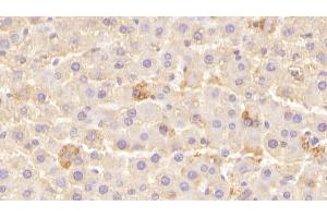 Detection of LEPR in Rat Liver Tissue using Polyclonal Antibody to Leptin Receptor (LEPR) (Leptin Receptor 抗体  (AA 238-375))