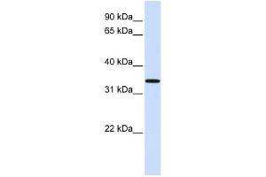 C16ORF78 antibody used at 1 ug/ml to detect target protein. (C16orf78 抗体  (Middle Region))