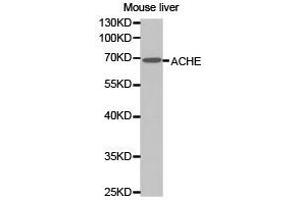 Western Blotting (WB) image for anti-Acetylcholinesterase (AChE) antibody (ABIN1870760)