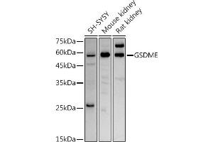 Western blot analysis of extracts of various cell lines, using GSDME antibody (ABIN6127757, ABIN6139554, ABIN6139555 and ABIN6223304) at 1:1000 dilution. (Non-Syndromic Hearing Impairment Protein 5 (GSDME) (AA 1-260) 抗体)