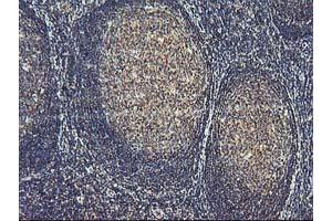 Image no. 6 for anti-Activating Signal Cointegrator 1 Complex Subunit 1 (ASCC1) antibody (ABIN1496741) (ASCC1 抗体)