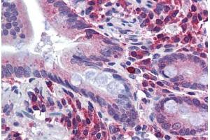 Human Small Intestine: Formalin-Fixed, Paraffin-Embedded (FFPE) (SPRY2 抗体  (AA 107-156))