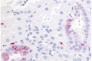 Immunohistochemistry (Paraffin-embedded Sections) (IHC (p)) image for anti-Prostaglandin E Receptor 2 (Subtype EP2), 53kDa (PTGER2) (Extracellular Domain) antibody (ABIN213469)
