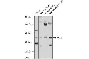 Western blot analysis of extracts of various cell lines, using PRRX1 antibody (ABIN6128507, ABIN6146277, ABIN6146278 and ABIN6214409) at 1:1000 dilution. (PRRX1 抗体  (AA 1-90))