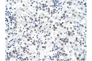 FECH antibody was used for immunohistochemistry at a concentration of 4-8 ug/ml to stain Hepatocytes (arrows) in Human Liver. (FECH 抗体)
