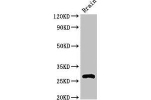 Western Blot Positive WB detected in: Mouse brain tissue All lanes: DNAJC4 antibody at 3. (DNAJC4 抗体  (AA 1-155))