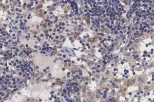 ABIN6266699 at 1/100 staining human lymph node tissue sections by IHC-P. (TRIM24 抗体  (C-Term))
