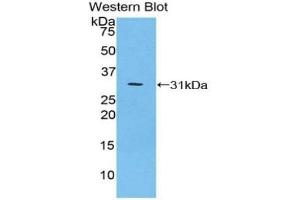 Detection of Recombinant IkBz, Mouse using Polyclonal Antibody to Inhibitory Subunit Of NF Kappa B Zeta (IkBz) (Inhibitory Subunit of NF-KappaB zeta (AA 414-654) 抗体)