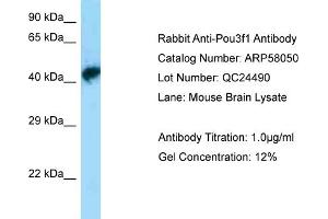 Western Blotting (WB) image for anti-POU Class 3 Homeobox 1 (POU3F1) (N-Term) antibody (ABIN2787528)