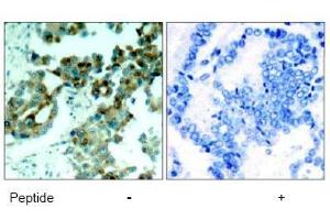 Image no. 1 for anti-Ribosomal Protein S6 (RPS6) (AA 233-237) antibody (ABIN197470) (RPS6 抗体  (AA 233-237))