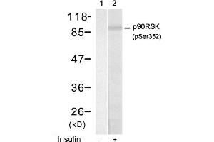 Image no. 1 for anti-Ribosomal Protein S6 Kinase, 90kDa, Polypeptide 1 (RPS6KA1) (pSer352) antibody (ABIN319221) (RPS6KA1 抗体  (pSer352))