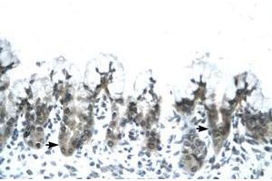 Image no. 1 for anti-Adiponectin (ADIPOQ) (AA 77-126) antibody (ABIN202115) (ADIPOQ 抗体  (AA 77-126))