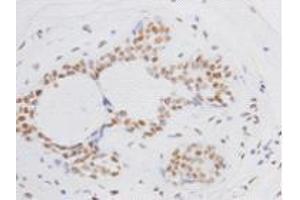 Immunohistochemistry (Paraffin-embedded Sections) (IHC (p)) image for anti-BMI1 Polycomb Ring Finger Oncogene (BMI1) antibody (ABIN1112825) (BMI1 抗体)