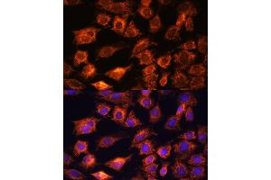 Immunofluorescence analysis of C6 cells using PTCD1 antibody (ABIN7269203) at dilution of 1:100. (PTCD1 抗体  (AA 435-537))