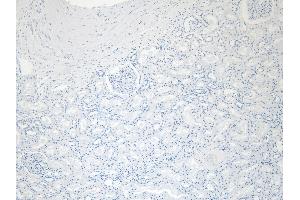 (ABIN185594) Negative Control showing staining of paraffin embedded Human Kidney, with no primary antibody (PRODH 抗体  (Internal Region))