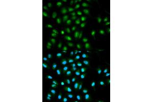 Immunofluorescence analysis of HeLa cells using PYCARD antibody (ABIN5970516). (PYCARD 抗体)