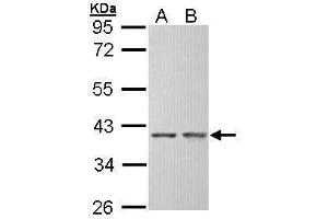 WB Image Sample (30 ug of whole cell lysate) A: Hep G2 , B: Molt-4 , 10% SDS PAGE antibody diluted at 1:5000 (SGTA 抗体  (Center))