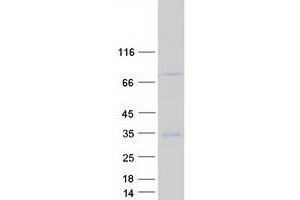 Western Blotting (WB) image for Glycoprotein M6A (GPM6A) (Transcript Variant 1) protein (Myc-DYKDDDDK Tag) (ABIN2722168)