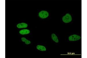 Immunofluorescence of purified MaxPab antibody to BRD2 on HeLa cell.