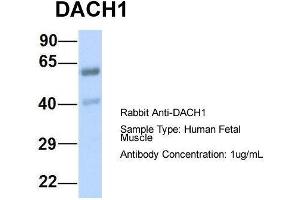 Host:  Rabbit  Target Name:  DACH1  Sample Type:  Human Fetal Muscle  Antibody Dilution:  1. (DACH1 抗体  (N-Term))
