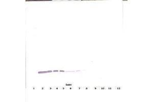 Image no. 2 for anti-Colony Stimulating Factor 2 (Granulocyte-Macrophage) (CSF2) antibody (ABIN465747) (GM-CSF 抗体)