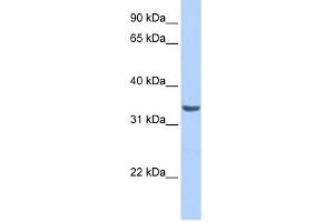 RAB40A antibody used at 1 ug/ml to detect target protein. (RAB40A 抗体  (Middle Region))