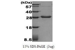Figure annotation denotes ug of protein loaded and % gel used. (ADIPOQ 蛋白)