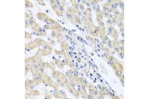 Immunohistochemistry of paraffin-embedded human liver injury using ITPKB antibody (ABIN5972108) at dilution of 1/100 (40x lens). (ITPKB 抗体)