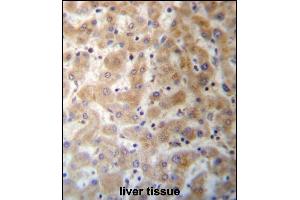 DHFRL1 Antibody (Center) (ABIN657287 and ABIN2846374) immunohistochemistry analysis in formalin fixed and paraffin embedded human liver tissue followed by peroxidase conjugation of the secondary antibody and DAB staining. (DHFRL1 抗体  (AA 45-74))