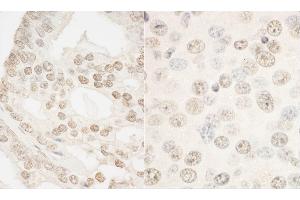 Immunohistochemistry (IHC) image for anti-Forkhead Box P1 (FOXP1) (AA 627-677) antibody (ABIN7454845)