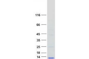 Western Blotting (WB) image for Chemokine (C-C Motif) Ligand 3-Like 1 (CCL3L1) protein (Myc-DYKDDDDK Tag) (ABIN2724560)