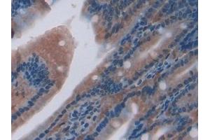 Detection of CXCL7 in Rat Small intestine Tissue using Polyclonal Antibody to Chemokine (C-X-C motif) ligand 7 ( CXCL7) (CXCL7 抗体  (AA 46-107))