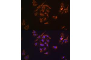 Immunofluorescence analysis of H9C2 cells using TRH Rabbit pAb (ABIN7270826) at dilution of 1:100. (TRH 抗体  (AA 100-200))