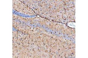 IHC analysis of Aquaporin 4 using anti-Aquaporin 4 antibody (ABIN3043789). (Aquaporin 4 抗体  (C-Term))