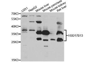 Western Blotting (WB) image for anti-Hydroxysteroid (17-Beta) Dehydrogenase 13 (HSD17B13) (AA 20-300) antibody (ABIN6142006)