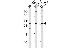 Western blot analysis of lysates from HepG2, MCF-7, U-2OS cell line (from left to right), using ID1 Antibody at 1:1000 at each lane. (ID1 抗体  (AA 66-93))