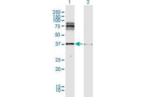 Western Blot analysis of DCT expression in transfected 293T cell line by DCT MaxPab polyclonal antibody. (DCT 抗体  (AA 1-519))