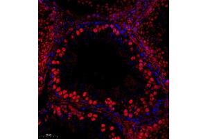 Immunofluorescent analysis of paraffin embedded mouse testis using RPL10L (ABIN7075429) at dilution of 1: 650 (RPL10L 抗体)