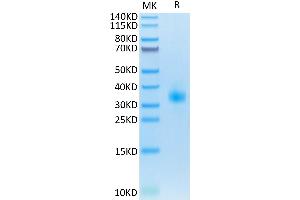 SDS-PAGE (SDS) image for Sclerostin (SOST) (AA 24-211) protein (His tag) (ABIN7275638)