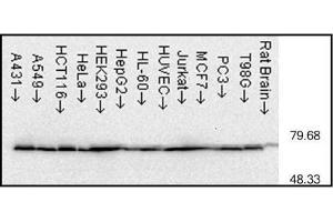 Western blot analysis of Hsp70 using capture antibody.