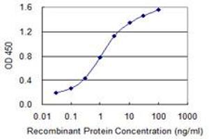Detection limit for recombinant GST tagged LMTK3 is 0. (LMTK3 抗体  (AA 1151-1250))