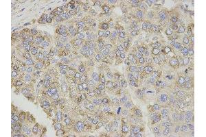 Immunohistochemistry (IHC) image for anti-Carnitine Palmitoyltransferase 1A (Liver) (CPT1A) antibody (ABIN1876495) (CPT1A 抗体)
