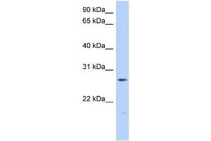 WB Suggested Anti-MTHFS Antibody Titration: 0. (MTHFS 抗体  (Middle Region))