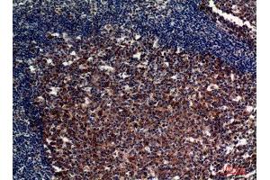 Immunohistochemistry (IHC) image for anti-Complement Component (3d/Epstein Barr Virus) Receptor 2 (CR2) (Internal Region) antibody (ABIN6283614)
