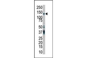 The anti-PKD2 Pab (ABIN392443 and ABIN2842041) is used in Western blot to detect PKD2 in HL-60 cell lysate. (PKD2 抗体  (C-Term))