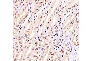 Immunohistochemistry (Paraffin-embedded Sections) (IHC (p)) image for anti-Zinc Finger Protein 307 (ZKSCAN4) antibody (ABIN7076265)