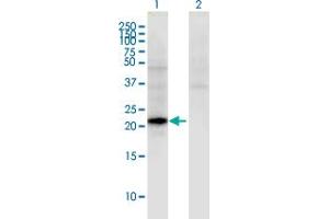 Western Blot analysis of CGB5 expression in transfected 293T cell line by CGB5 monoclonal antibody (M02), clone 2E7. (CGB5 抗体  (AA 1-165))