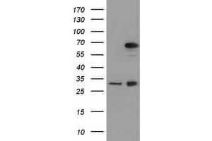 Western Blotting (WB) image for anti-Membrane Protein, Palmitoylated 3 (MAGUK P55 Subfamily Member 3) (MPP3) antibody (ABIN1499549) (MPP3 抗体)