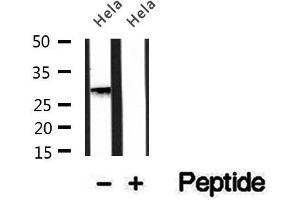 Western blot analysis of extracts of HepG2 cells, using PMM2 antibody. (PMM2 抗体  (C-Term))